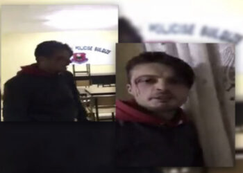 Dhunimi i të riut në Bulqizë, sqarohet Policia: Ishte ai që rrahu policët