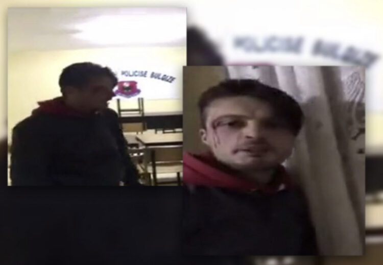 Dhunimi i të riut në Bulqizë, sqarohet Policia: Ishte ai që rrahu policët