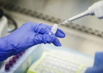 Nesër nis kryerja e testit të shpejtë për Covid-19, 6 qendrat në Tiranë që do të testojnë deri në 70 persona në ditë, rastet referohen nga mjekët e familjes