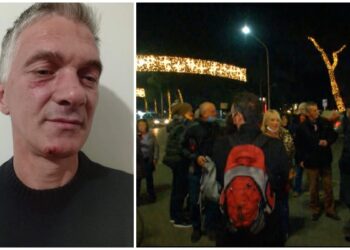 “Më gjuajtën me shkelma në komisariat”/ Pedagogu Donald Martini: Do ta hedh në gjyq rajonin e policisë