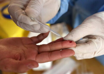 Studiuesit zbulojnë testin e ri të gjakut/ Parashikon nëse mund të mbijetojë një i infektuar me Covid-19