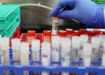 ‘B1525’, zbulohet varianti i ri i COVID-19 në Mbretërinë e Bashkuar