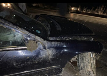 Aksident në Elbasan, makina përplas një këmbësore, e plagosura rëndë në spital