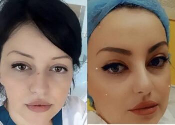 Bashkëpunonte me Tiren për të ndarë paratë, kush është infermierja që u arrestua për skandalin tek ‘Shefqet Ndroqi’