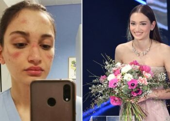 Prej një viti lufton me COVID-19, kjo është infermierja italiane që u ngjit në skenën e Sanremo 2021