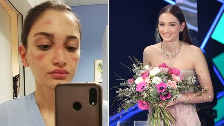 Prej një viti lufton me COVID-19, kjo është infermierja italiane që u ngjit në skenën e Sanremo 2021