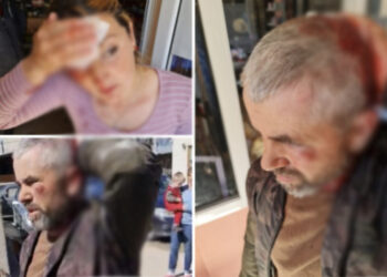 Burrë dhe grua u goditën me karrige në Maliq! Çifti: Na dhunuan djemtë e kryeplaku