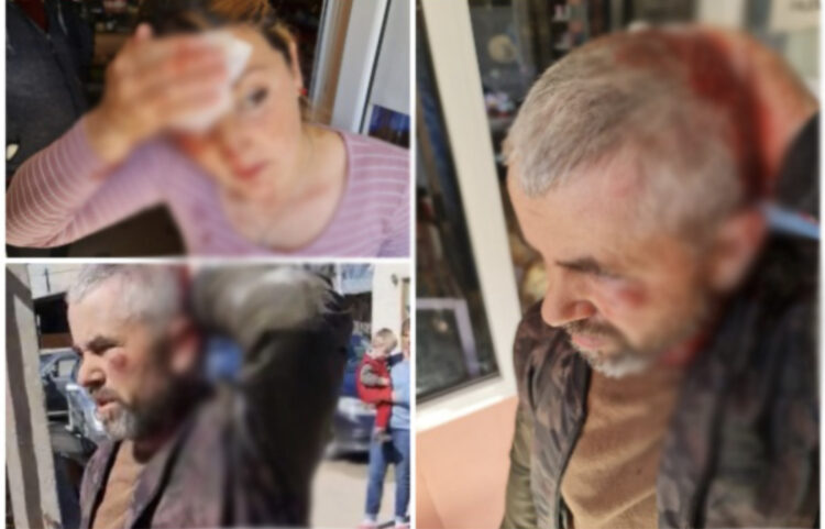 Burrë dhe grua u goditën me karrige në Maliq! Çifti: Na dhunuan djemtë e kryeplaku