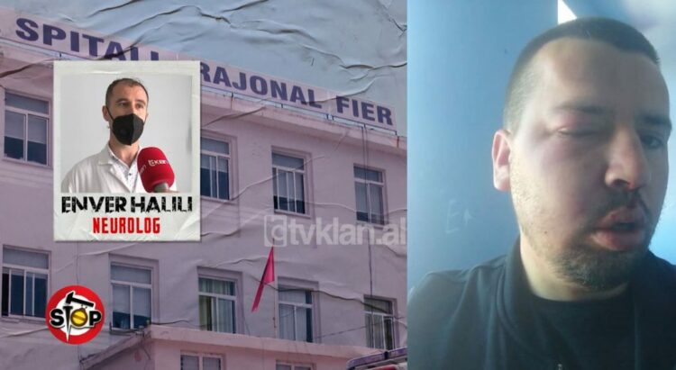 PAMJE TE RENDA/ 4 mjekë të spitalit të Fierit rrahin të riun