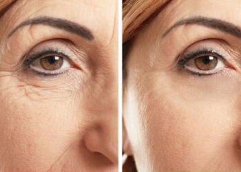 Nga dehidratimi deri tek mishi i kuq, gjashtë faktorë që mund të shtojnë rrudhat në lëkurën tuaj