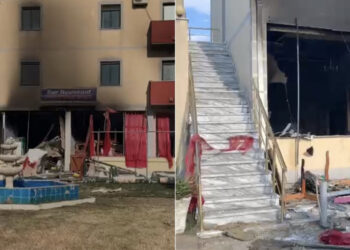 Shpërthimi i bombolës në një hotel në Velipojë, infermierja: Janë rëndë, me djegie në 90% të trupit