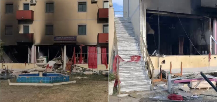 Shpërthimi i bombolës në një hotel në Velipojë, infermierja: Janë rëndë, me djegie në 90% të trupit