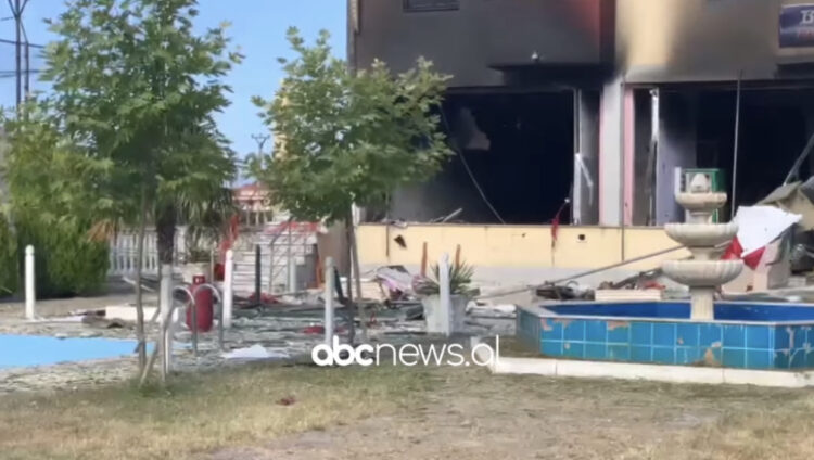 Katër të lënduar nga shpërthimi në Velipojë, QSUT: Me djegie të rënda në trup, po marrin kujdes intensiv