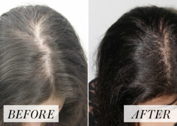 Konsumoni çajin e rozmarinës, fantastik për flokët tuaja (Përgatitja dhe ndikimi)