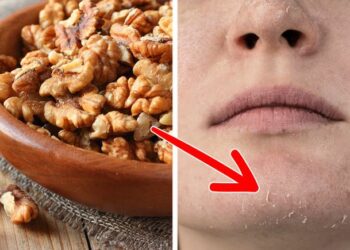 Çfarë mund të ndodhë me lëkurën tuaj nëse konsumoni arra çdo ditë? Ja përfitimet që do të keni