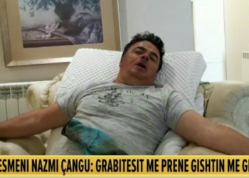 EMRI/ Grabitet banesa në Krujë, biznesmeni: 10 persona më prenë gishtin dhe morën 100 mijë euro