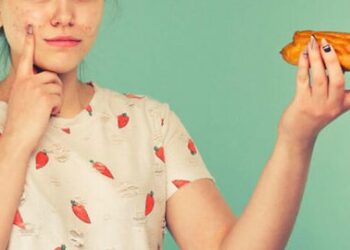 Cilat janë ushqimet që shkaktojnë akne?