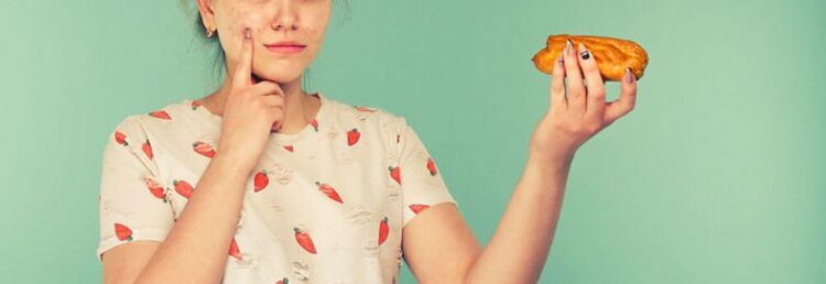 Cilat janë ushqimet që shkaktojnë akne?