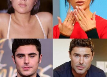 Mania e operacioneve plastike? 8 të famshëm që sot janë të transformuar në pamje