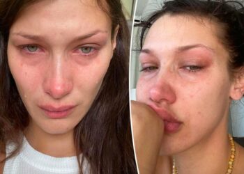 Bella Hadid zbulon betejat e saj ‘torturuese’ të shëndetit mendor