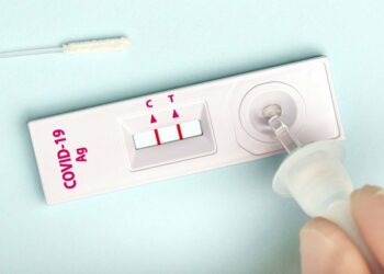 Kur duhet të bëni testin PCR dhe kur një test të shpejtë antigjeni