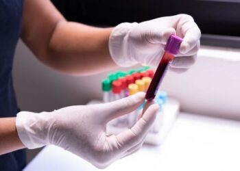 Arma e re e shkencëtarëve britanikë: Një test gjaku tashmë mund të zbulojë kancerin