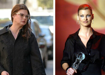 Linda Evangelista: Procedura kirurgjikale më la të shpërfytyruar