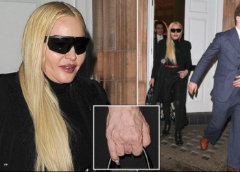 Si rrallëherë, publikohen foto të Madonna-s pa filtra e fotoshop