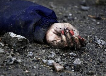 FOTO/ Dora që tronditi botën në Bucha është e Irinës