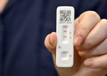 36-vjeçari italian del pozitiv njëkohësisht me HIV, Covid dhe linë e majmunit
