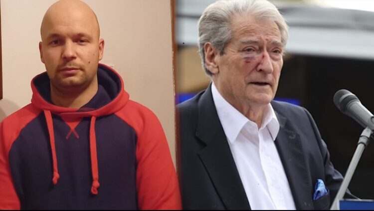 Goditi me grusht Berishën, Gert Shehut i komunikohet masa ‘arrest me burg’ te ‘Trauma’! Transferohet në qeli pasi të lërë spitalin